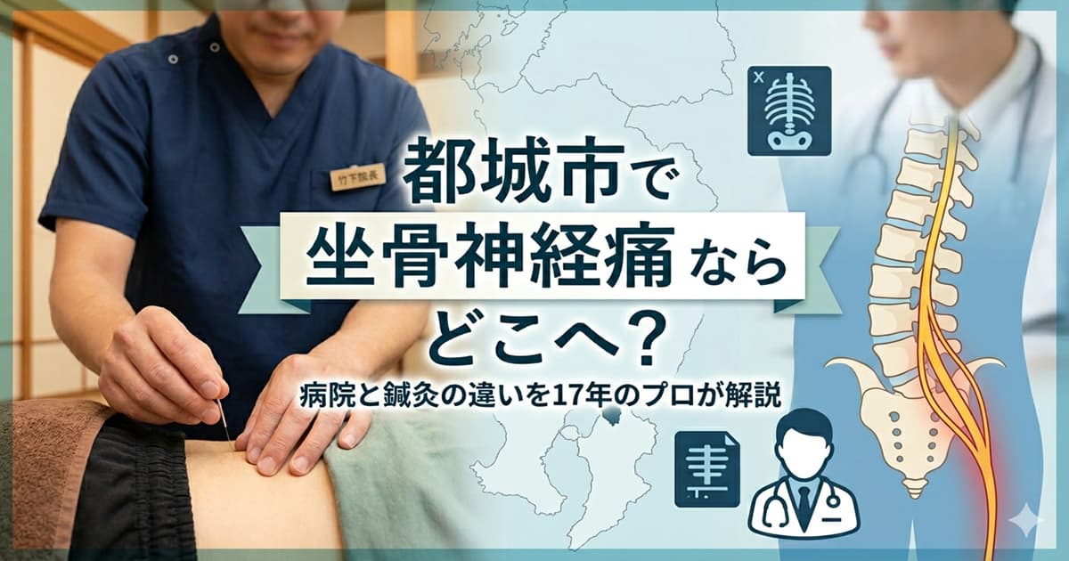 都城市で坐骨神経痛の治療法を比較する鍼灸師のイメージ画像