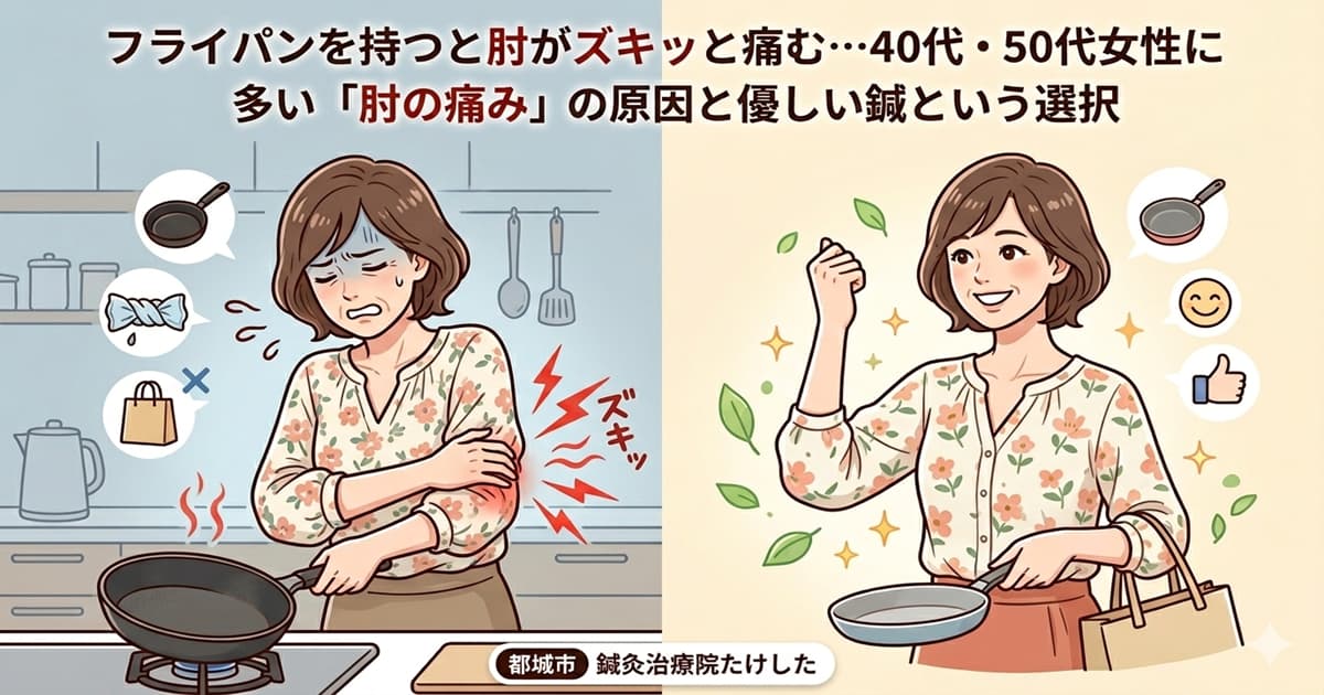 都城市で肘の痛み（テニス肘）に悩む40代・50代女性が鍼灸治療で改善し笑顔になる様子を描いたアイキャッチ画像